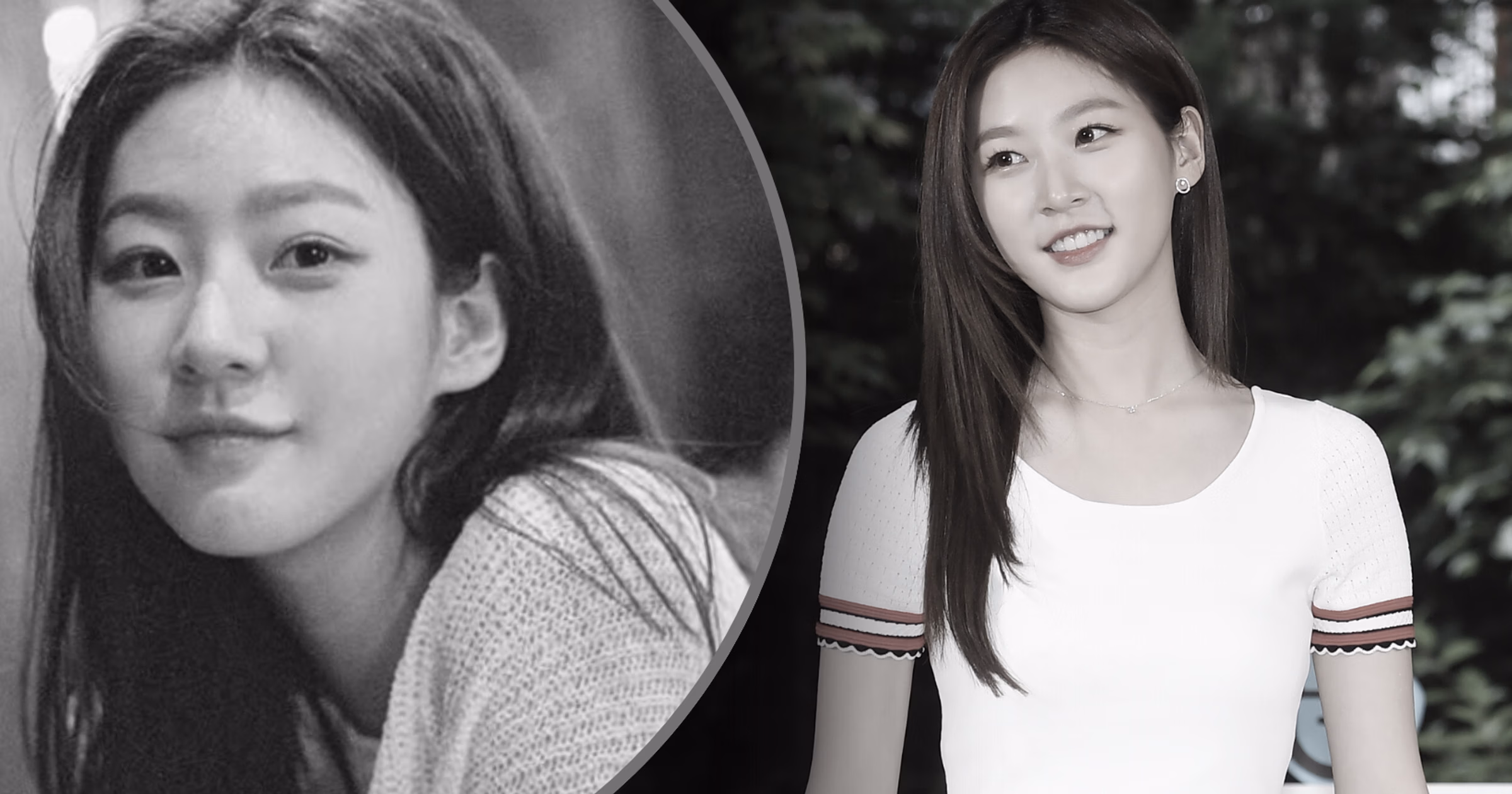 Kim Sae Ron Cause Of Death